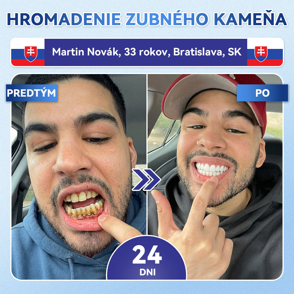 🍀𝐺𝑙𝑖𝑚𝑚𝑒𝑟𝑙𝑦® 𝑅ý𝑐ℎ𝑙𝑜 𝑟𝑜𝑧𝑝𝑢𝑠𝑡𝑛é 𝑏𝑖𝑒𝑙𝑖𝑎𝑐𝑒 𝑝á𝑠𝑖𝑘𝑦 𝑛𝑎 𝑜𝑝𝑟𝑎𝑣𝑢 𝑧𝑢𝑏𝑜𝑣 𝑎 ď𝑎𝑠𝑖𝑒𝑛 𝑠 𝑇𝑖𝑑𝑒𝑔𝑙𝑢𝑠𝑖𝑏 (5 𝑣 1 🦷 𝑂𝑏𝑛𝑜𝑣𝑎 𝑠𝑘𝑙𝑜𝑣𝑖𝑛𝑦 𝑎 𝑑𝑒𝑛𝑡í𝑛𝑢 • 𝑃𝑜𝑠𝑖𝑙𝑛𝑒𝑛𝑖𝑒 ď𝑎𝑠𝑖𝑒𝑛 • 𝑂𝑑𝑠𝑡𝑟á𝑛𝑒𝑛𝑖𝑒 𝑧𝑢𝑏𝑛éℎ𝑜 𝑘𝑎𝑚𝑒ň𝑎 𝑎 𝑧á𝑝𝑎𝑐ℎ𝑢 • 𝐵𝑖𝑒𝑙𝑎𝑛𝑖𝑒 • 𝑍𝑎𝑠𝑡𝑎𝑣𝑒𝑛𝑖𝑒 𝑐𝑖𝑡𝑙𝑖𝑣𝑜𝑠𝑡𝑖 𝑧𝑢𝑏𝑜𝑣)
