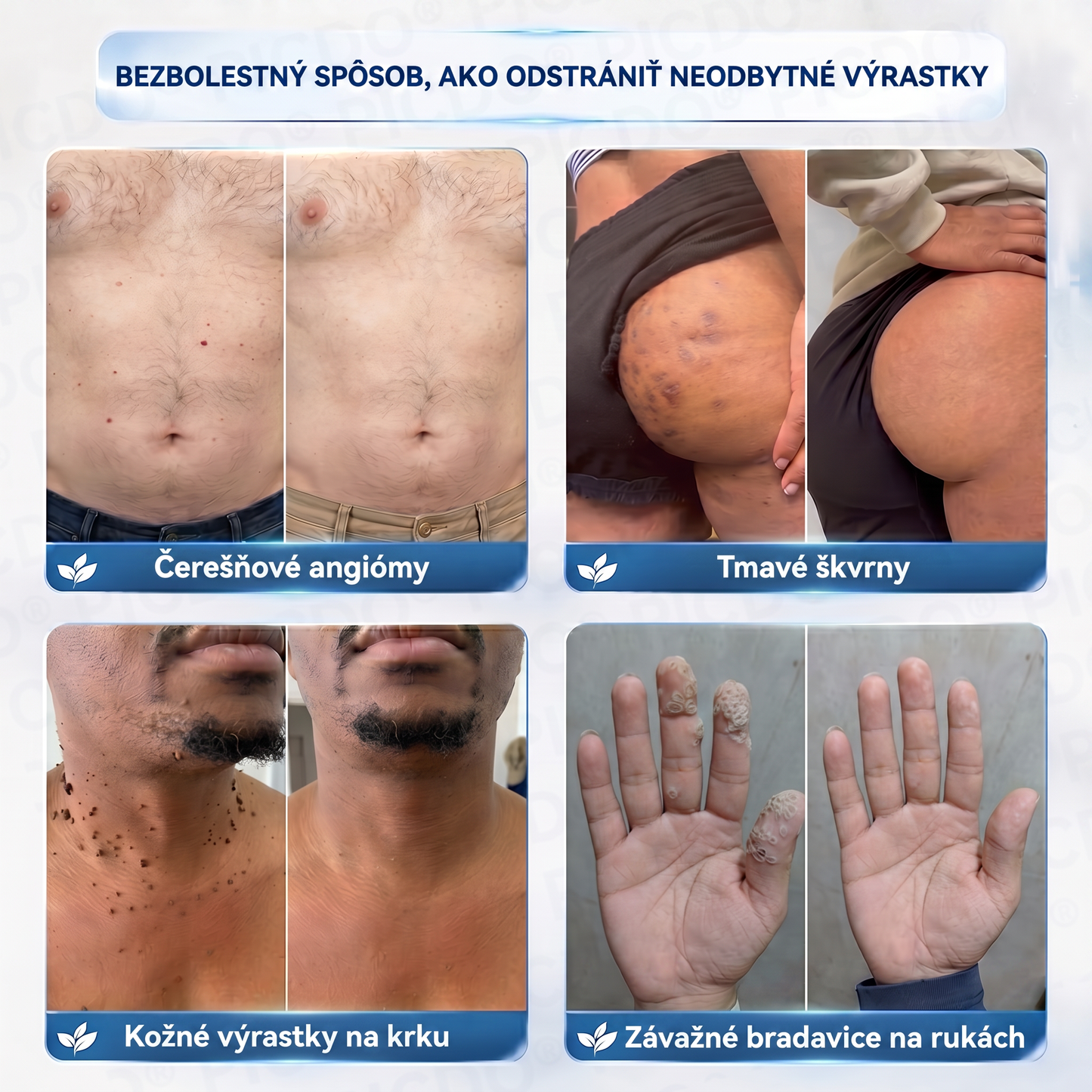 𝐏𝐢𝐜𝐝𝐨®🩷7-𝑫ň𝒐𝒗ý 𝑲𝒓é𝒎 𝑵𝒂 𝑶𝒅𝒔𝒕𝒓𝒂𝒏𝒐𝒗𝒂𝒏𝒊𝒆𝒌𝒐ž𝒏ý𝒄𝒉 𝑽ý𝒓𝒂𝒔𝒕𝒌𝒐𝒗 𝑨 Š𝒌𝒗ř𝒏🩵 (Receptúra bez bolesti a bez jaziev) 💪