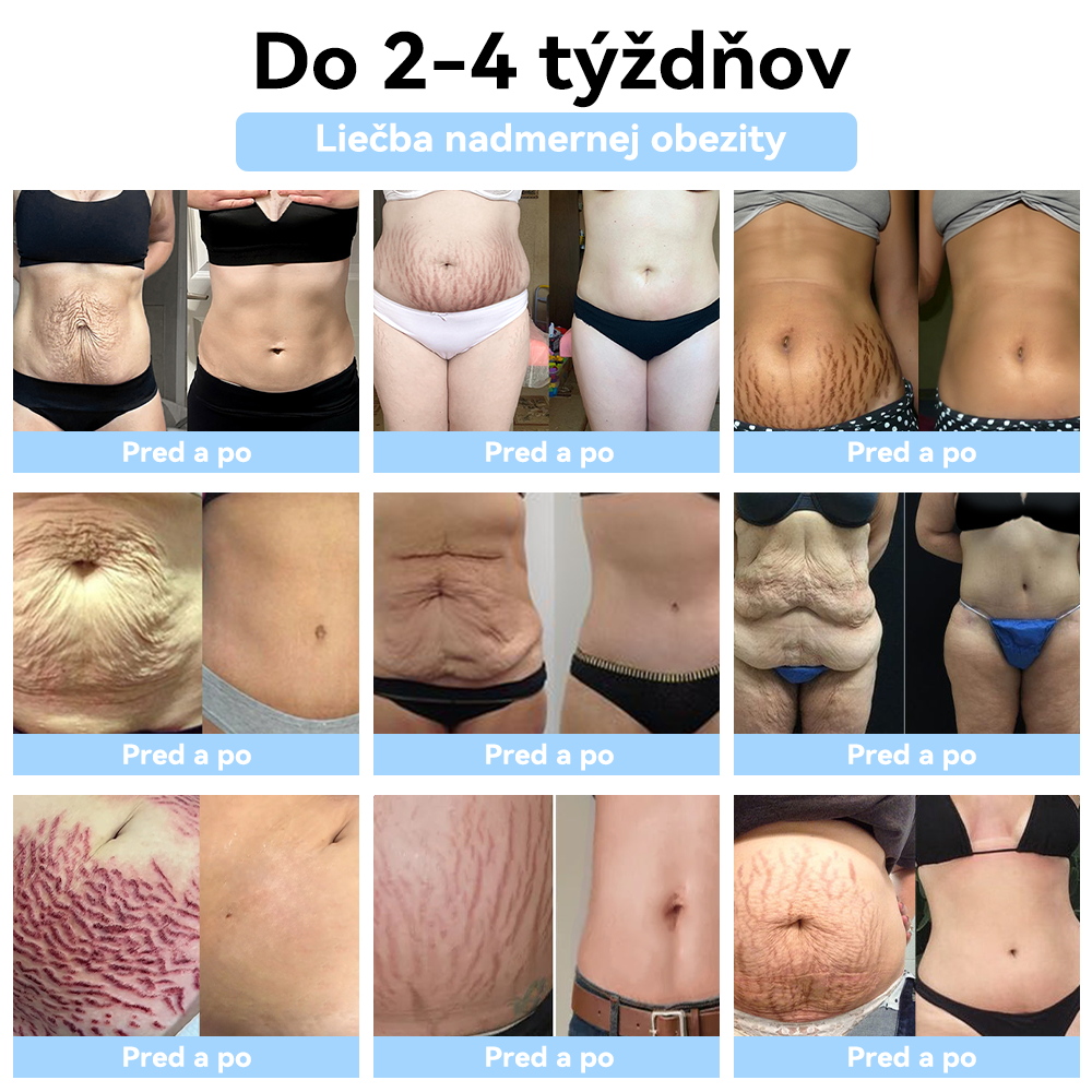 ⚡𝐏𝐎𝐒𝐋𝐄𝐃𝐍Ý 𝐃𝐄Ň 𝟕𝟎% 𝐙Ľ𝐀𝐕𝐀⚡ 𝐒𝐂𝐍𝐃𝐑® 𝐔𝐥𝐭𝐫𝐚𝐳𝐯𝐮𝐤 𝐫𝐨𝐳𝐛𝐢𝐭𝐢𝐞 𝐭𝐮𝐤𝐮 & 𝐢𝐧𝐟𝐫𝐚č𝐞𝐫𝐯𝐞𝐧á 𝐫𝐨𝐯𝐧𝐨𝐯á𝐡𝐚 𝐡𝐥𝐚𝐝𝐢𝐧𝐲 𝐜𝐮𝐤𝐫𝐮 𝐯 𝐤𝐫𝐯𝐢 𝐝𝐞𝐭𝐨𝐱𝐢𝐤𝐚č𝐧ý 𝐧á𝐫𝐚𝐦𝐨𝐤