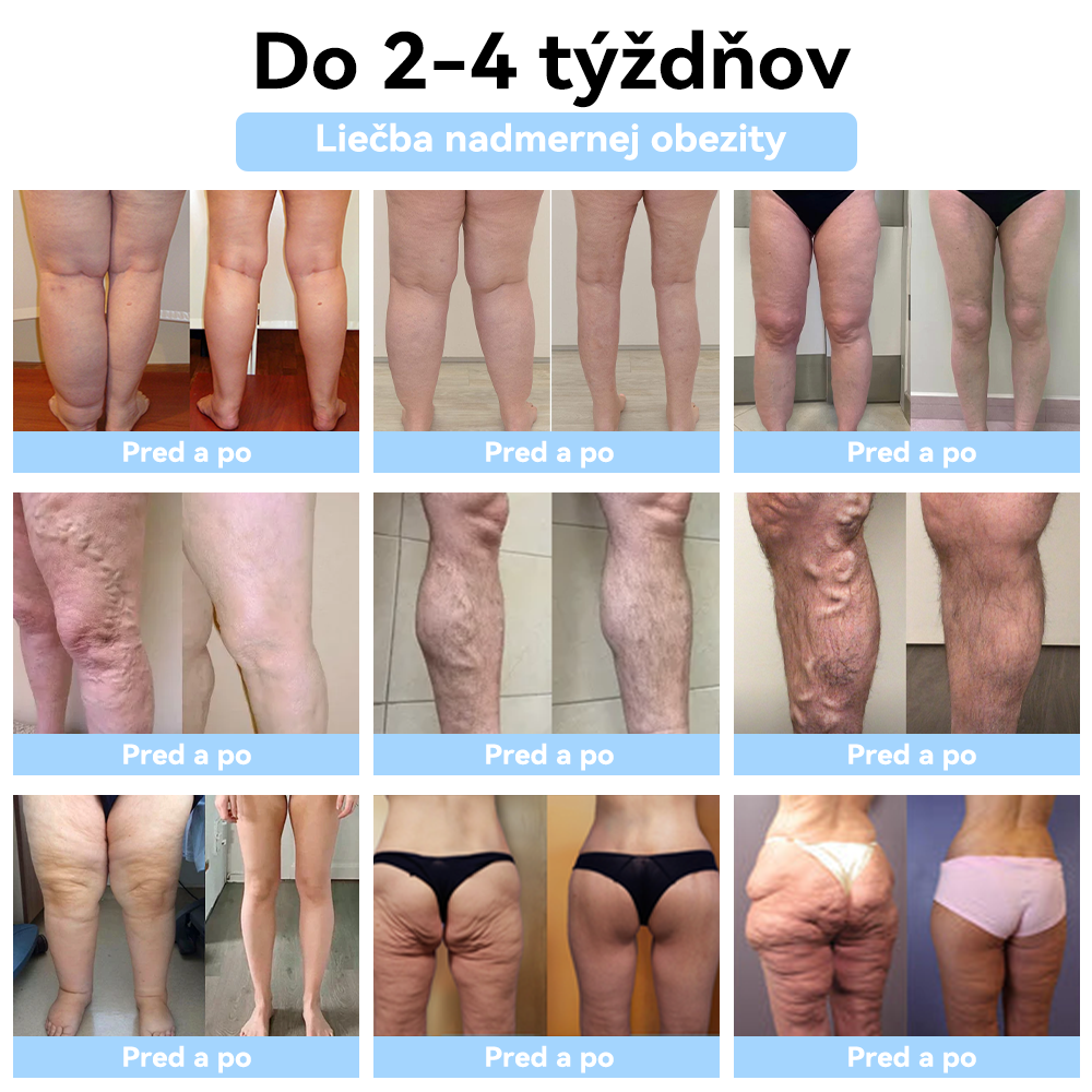 ⚡𝐏𝐎𝐒𝐋𝐄𝐃𝐍Ý 𝐃𝐄Ň 𝟕𝟎% 𝐙Ľ𝐀𝐕𝐀⚡ 𝐒𝐂𝐍𝐃𝐑® 𝐔𝐥𝐭𝐫𝐚𝐳𝐯𝐮𝐤 𝐫𝐨𝐳𝐛𝐢𝐭𝐢𝐞 𝐭𝐮𝐤𝐮 & 𝐢𝐧𝐟𝐫𝐚č𝐞𝐫𝐯𝐞𝐧á 𝐫𝐨𝐯𝐧𝐨𝐯á𝐡𝐚 𝐡𝐥𝐚𝐝𝐢𝐧𝐲 𝐜𝐮𝐤𝐫𝐮 𝐯 𝐤𝐫𝐯𝐢 𝐝𝐞𝐭𝐨𝐱𝐢𝐤𝐚č𝐧ý 𝐧á𝐫𝐚𝐦𝐨𝐤