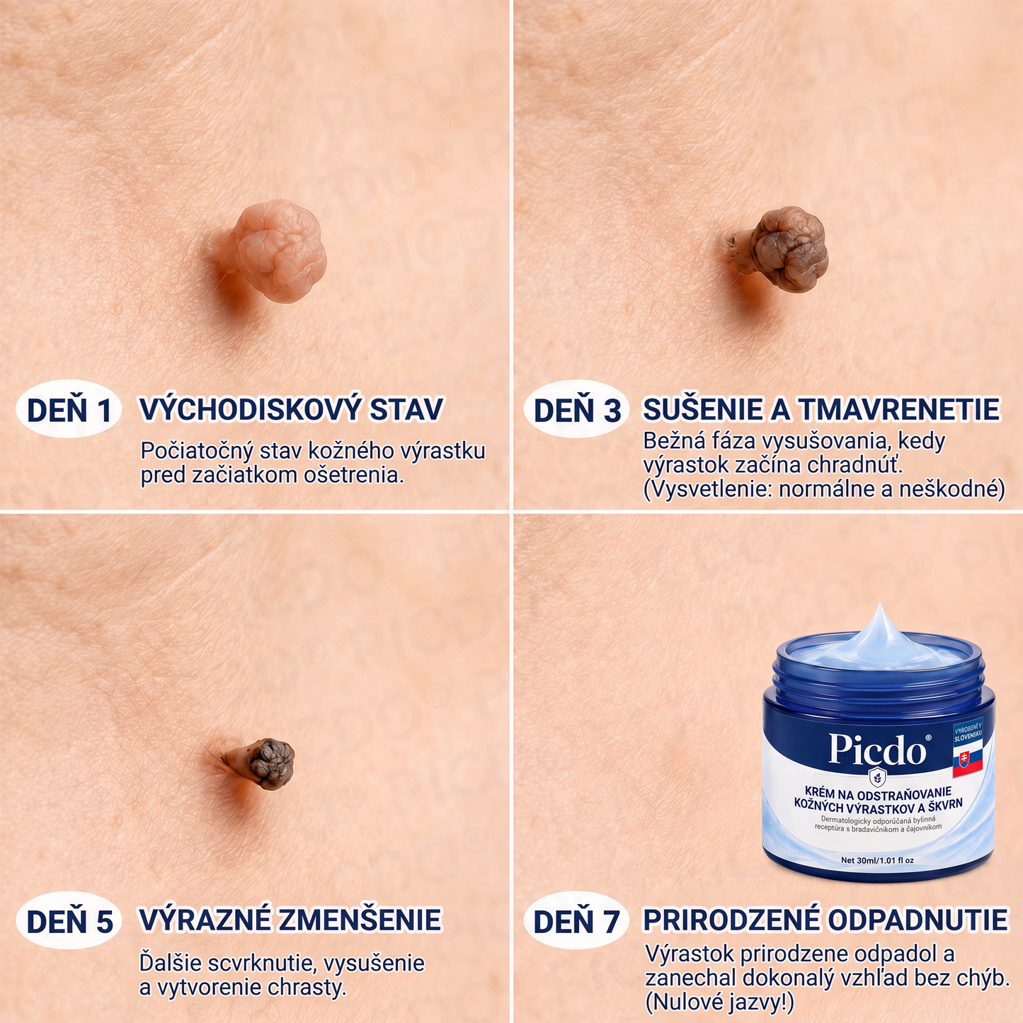 𝐏𝐢𝐜𝐝𝐨®🩷7-𝑫ň𝒐𝒗ý 𝑲𝒓é𝒎 𝑵𝒂 𝑶𝒅𝒔𝒕𝒓𝒂𝒏𝒐𝒗𝒂𝒏𝒊𝒆𝒌𝒐ž𝒏ý𝒄𝒉 𝑽ý𝒓𝒂𝒔𝒕𝒌𝒐𝒗 𝑨 Š𝒌𝒗ř𝒏🩵 (Receptúra bez bolesti a bez jaziev) 💪