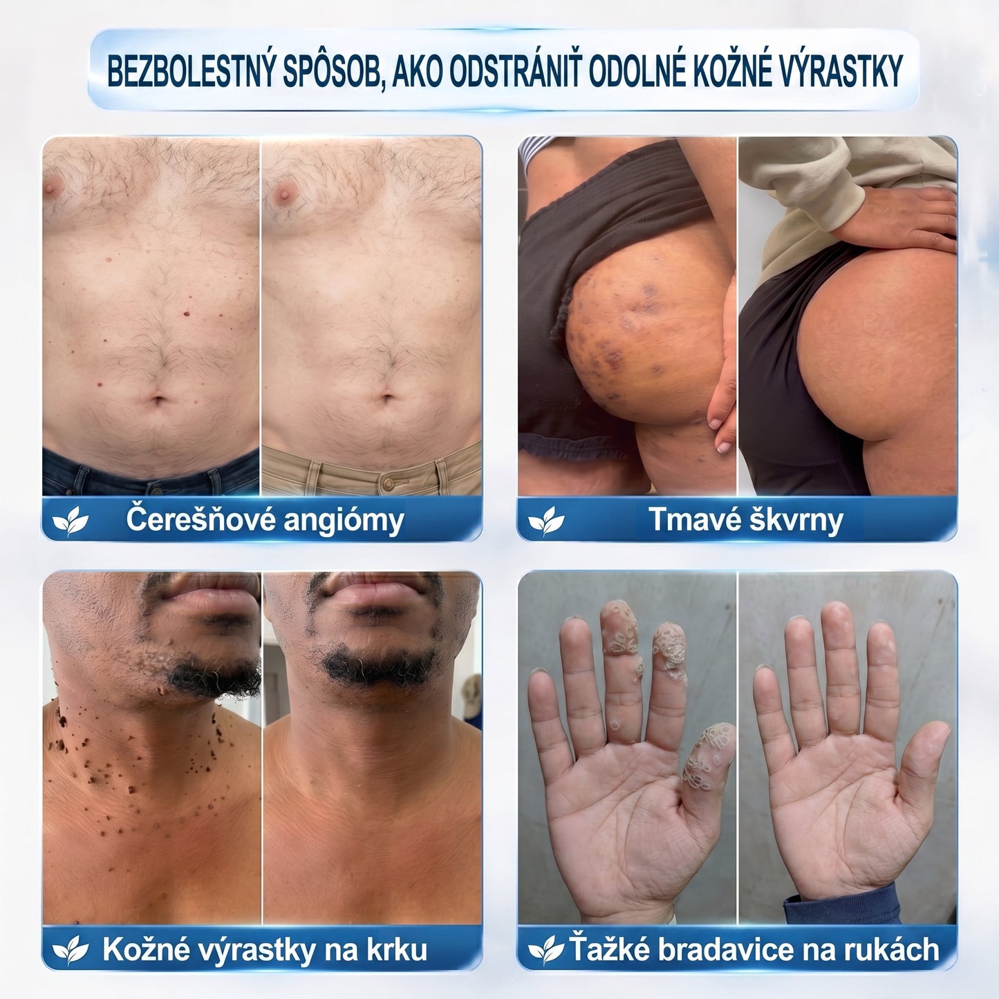 𝐏𝒊𝐜𝐝𝒐®🍒 7-𝑫ň𝒐𝒗ý 𝑵𝒂 𝑶𝒅𝒔𝒕𝒓𝒂ň𝒐𝒗𝒂𝒏𝒊𝒆 𝑷𝒊𝒈𝒎𝒆𝒏𝒕𝒐𝒗ý𝒄𝒉 Š𝒌𝒗ŕ𝒏 𝑨 𝑱𝒂𝒛𝒊𝒆𝒗 𝑷𝒆𝒓𝒐(𝐵𝑒𝑧 𝑏𝑜𝑙𝑒𝑠𝑡𝑖, 𝑏𝑒𝑧 𝑗𝑎𝑧𝑖𝑒𝑣 – 𝑟𝑜𝑙𝑙𝑒𝑟𝑏𝑎𝑙𝑙)💪
