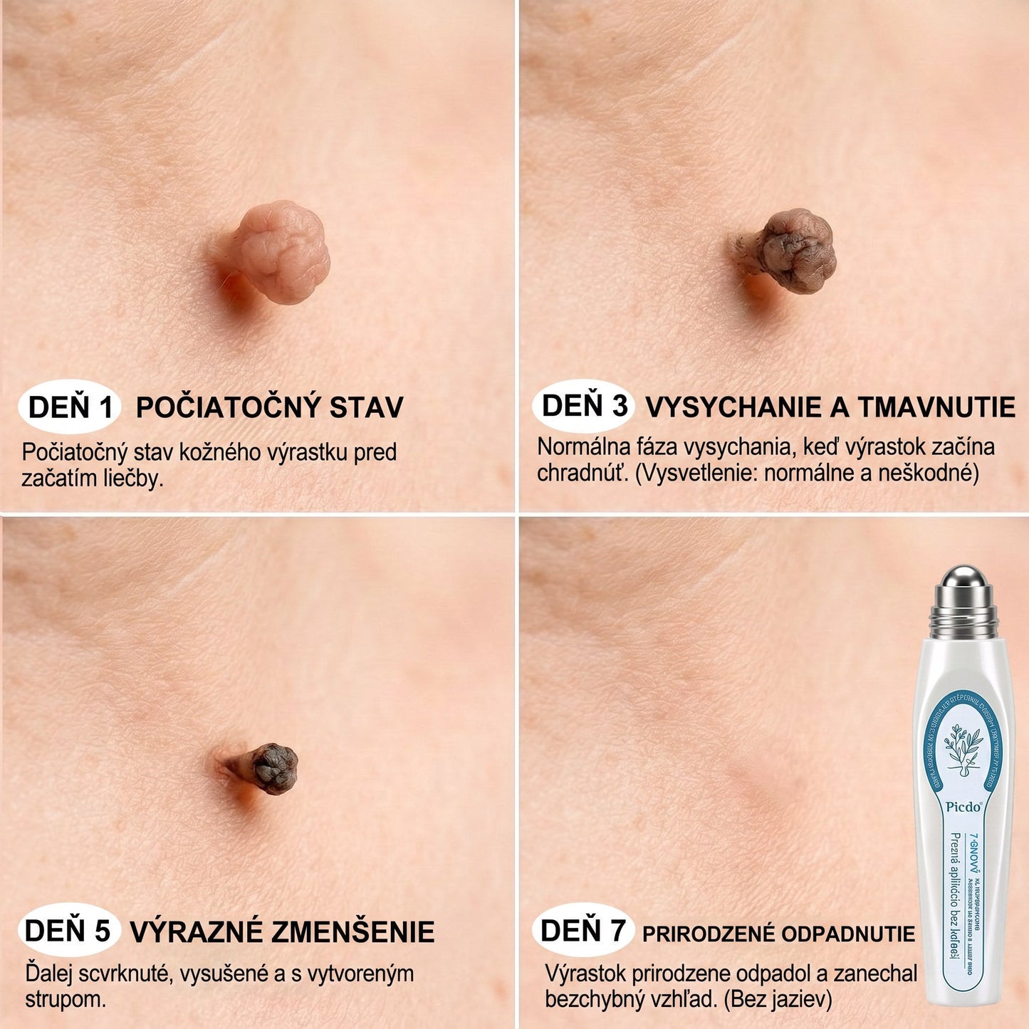 𝐏𝒊𝐜𝐝𝒐®🍒 7-𝑫ň𝒐𝒗ý 𝑵𝒂 𝑶𝒅𝒔𝒕𝒓𝒂ň𝒐𝒗𝒂𝒏𝒊𝒆 𝑷𝒊𝒈𝒎𝒆𝒏𝒕𝒐𝒗ý𝒄𝒉 Š𝒌𝒗ŕ𝒏 𝑨 𝑱𝒂𝒛𝒊𝒆𝒗 𝑷𝒆𝒓𝒐(𝐵𝑒𝑧 𝑏𝑜𝑙𝑒𝑠𝑡𝑖, 𝑏𝑒𝑧 𝑗𝑎𝑧𝑖𝑒𝑣 – 𝑟𝑜𝑙𝑙𝑒𝑟𝑏𝑎𝑙𝑙)💪