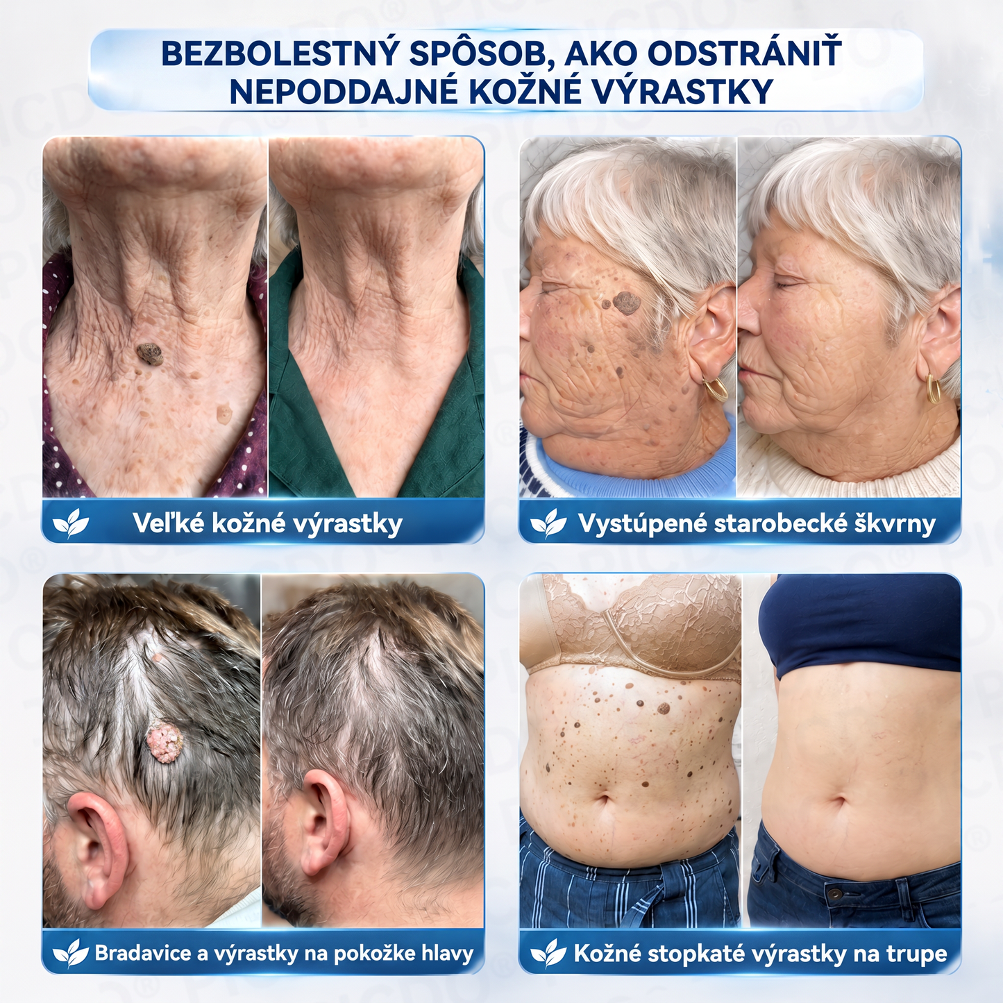 𝐏𝐢𝐜𝐝𝐨®🩷7-𝑫ň𝒐𝒗ý 𝑲𝒓é𝒎 𝑵𝒂 𝑶𝒅𝒔𝒕𝒓𝒂𝒏𝒐𝒗𝒂𝒏𝒊𝒆𝒌𝒐ž𝒏ý𝒄𝒉 𝑽ý𝒓𝒂𝒔𝒕𝒌𝒐𝒗 𝑨 Š𝒌𝒗ř𝒏🩵 (Receptúra bez bolesti a bez jaziev) 💪
