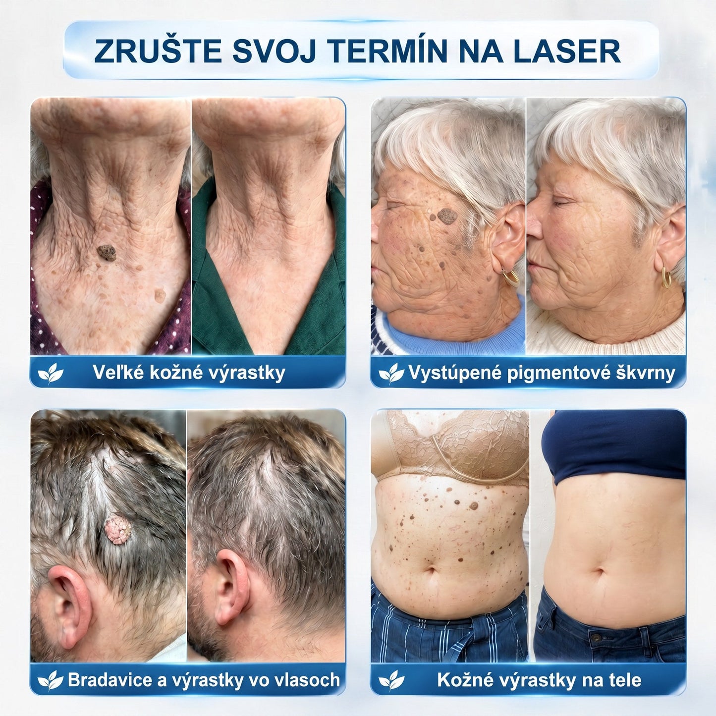 𝐏𝒊𝐜𝐝𝒐®🍒 7-𝑫ň𝒐𝒗ý 𝑵𝒂 𝑶𝒅𝒔𝒕𝒓𝒂ň𝒐𝒗𝒂𝒏𝒊𝒆 𝑷𝒊𝒈𝒎𝒆𝒏𝒕𝒐𝒗ý𝒄𝒉 Š𝒌𝒗ŕ𝒏 𝑨 𝑱𝒂𝒛𝒊𝒆𝒗 𝑷𝒆𝒓𝒐(𝐵𝑒𝑧 𝑏𝑜𝑙𝑒𝑠𝑡𝑖, 𝑏𝑒𝑧 𝑗𝑎𝑧𝑖𝑒𝑣 – 𝑟𝑜𝑙𝑙𝑒𝑟𝑏𝑎𝑙𝑙)💪