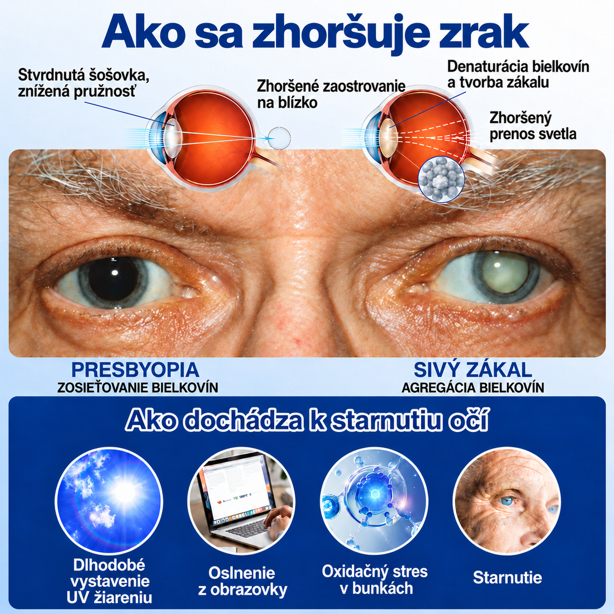 🇸🇰👨‍⚕️✅ Croaie® Nano kvapky na regeneráciu degenerujúcej očnej šošovky