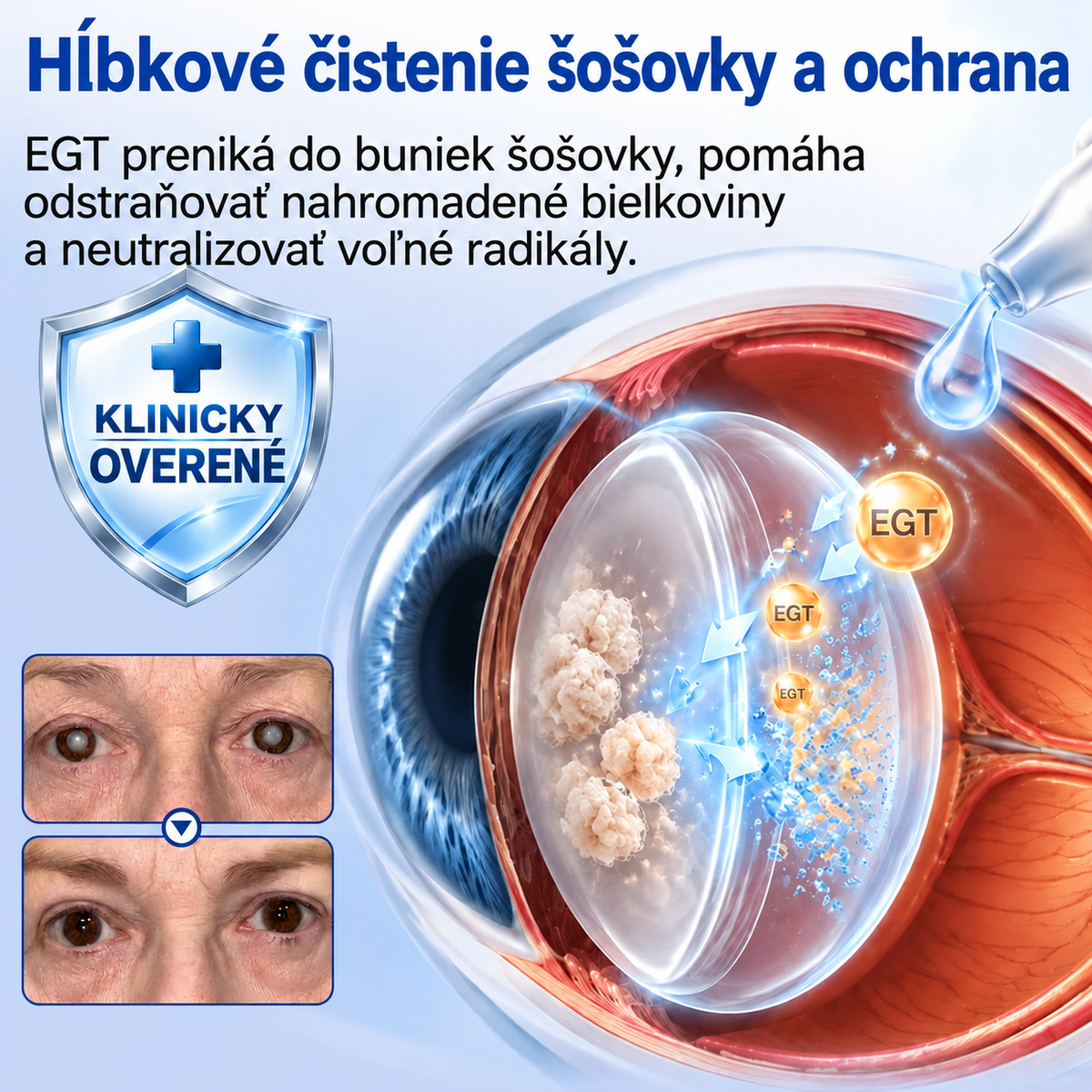 🇸🇰👨‍⚕️✅ Croaie® Nano kvapky na regeneráciu degenerujúcej očnej šošovky